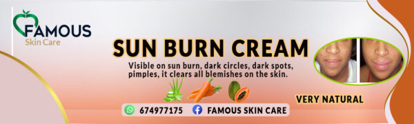 SUN BURN CREAM - Image 3